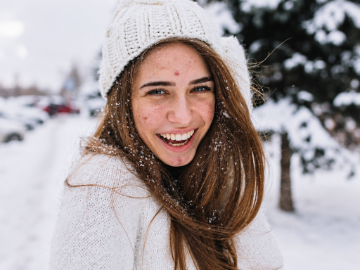 Laughing woman in a white knit beanie in the snow, a breakout across her forehead, cheeks and chin, before blemish removal